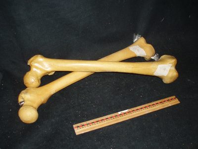 Plastic, femurs