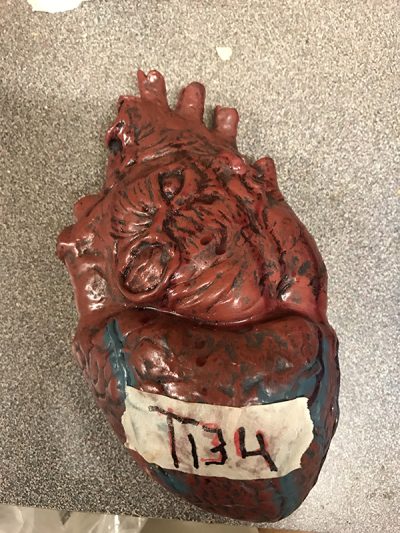 Human Heart